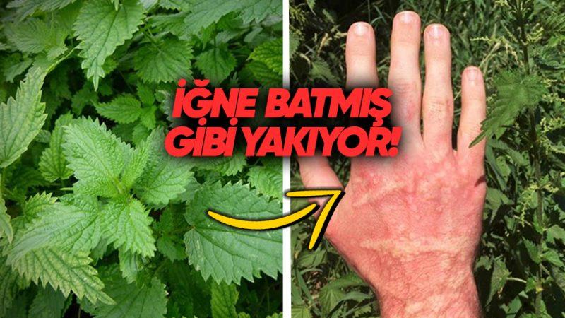 Isırgan Otu Neden Cildimizi Sanki İğne Batmışçasına Yakar?