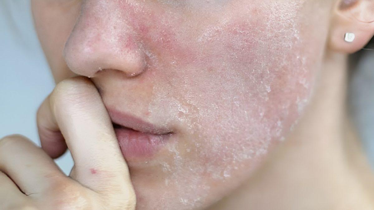 Çok Uzun Bir Uçuşun İnsan Vücuduna Olan Etkileri Nedir, Bunlarla Nasıl Başa Çıkabiliriz?