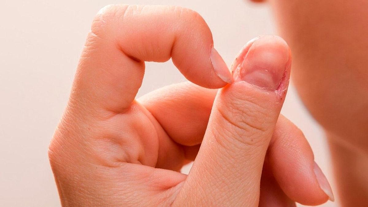 Stresliyken Neden Acısını Tırnaklarımızdan Çıkarıp Onları Koparıyoruz?