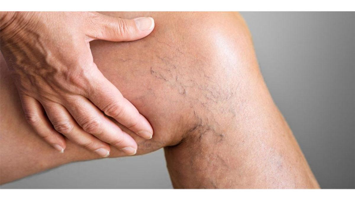 Bacaklardaki Kirli Kan Nasıl Oluyor da Yer Çekimine Rağmen Kalbe Doğru Geri Akıyor?