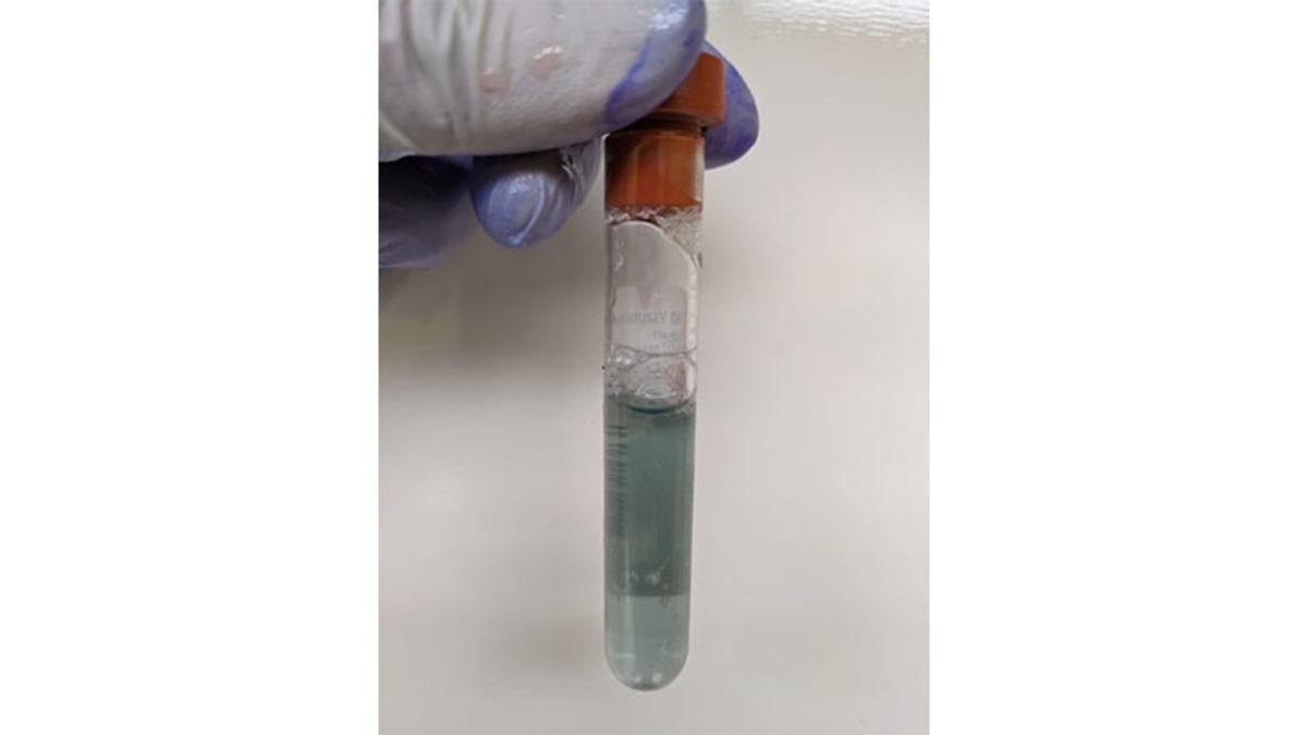 Normalde Kırmızı Olan Kanın Istakozlarda Mavi Olmasının Sizi Çok Şaşırtacak Sebebi