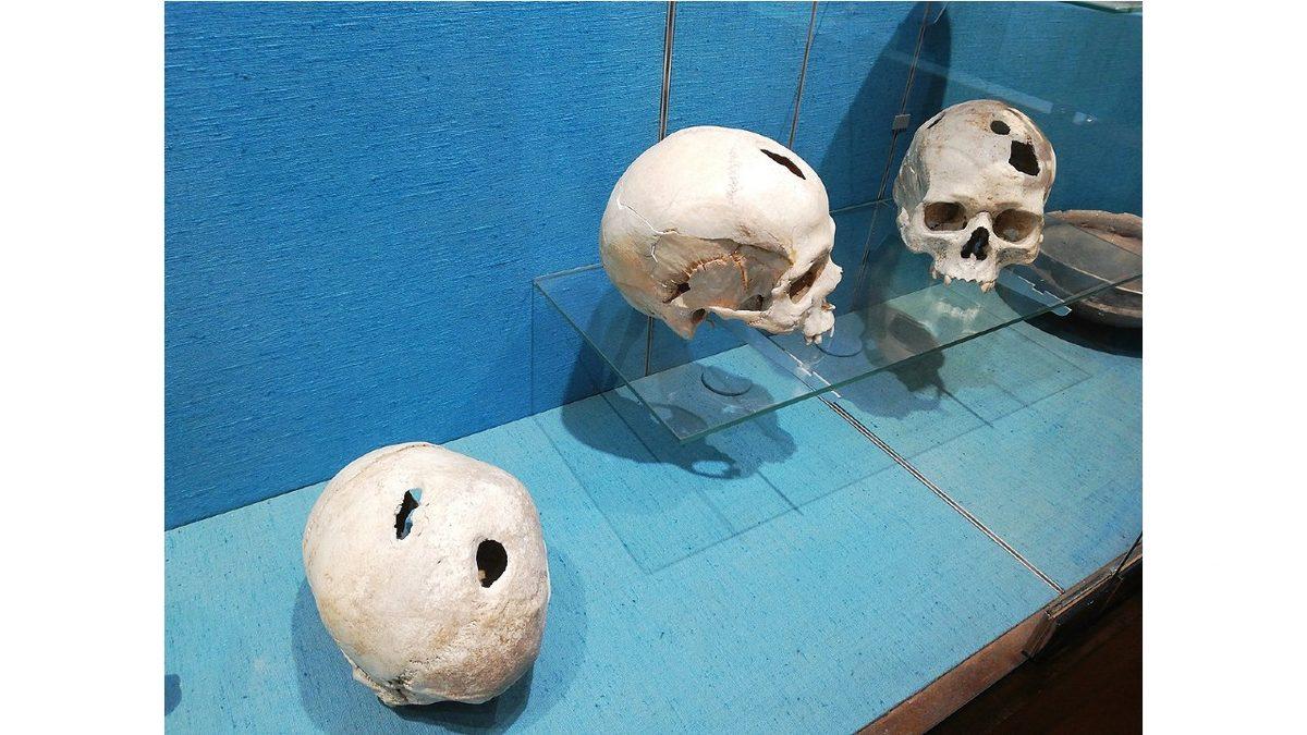 Eski Dönemlerde Neden İnsanların Kafasına Koca Koca Delikler Açılıyordu? (Günümüzde de Yapılabiliyor!)