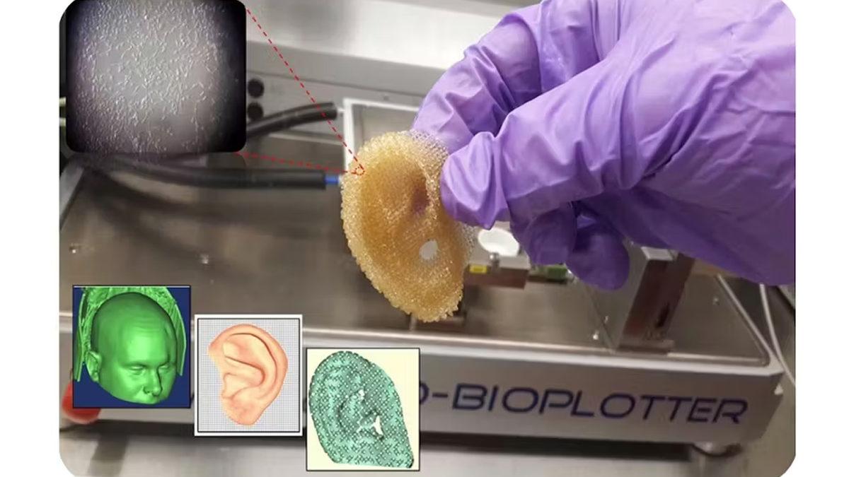 Belki de Gelecek Yıllarda Organ Nakli Diye Bir Şey Kalmayacak: Yapay Organlar ve Biyonik Uzuvlar Hayatımızı Nasıl Kökten Değiştirecek?