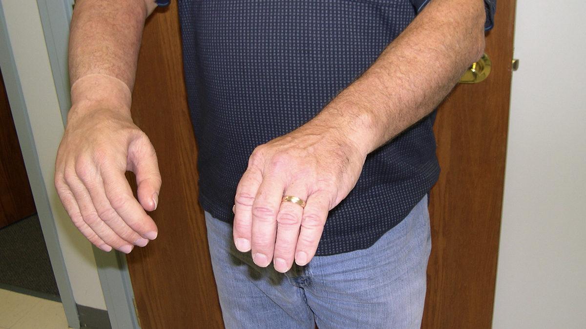 Belki de Gelecek Yıllarda Organ Nakli Diye Bir Şey Kalmayacak: Yapay Organlar ve Biyonik Uzuvlar Hayatımızı Nasıl Kökten Değiştirecek?