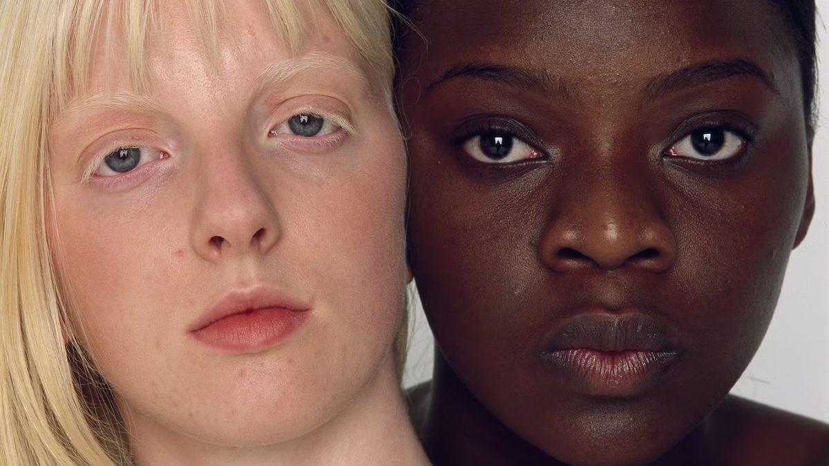 Ten Rengimiz Neden Tek Bir Renk Değil de Siyah ve Beyaz Olarak Evrimleşti? Şu An da Maruz Kaldığımız Bir Şey Yüzündenmiş!