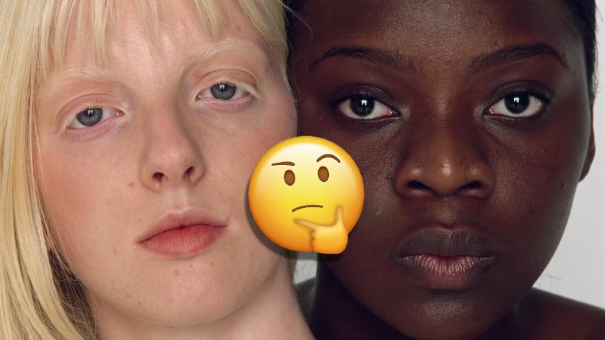 Ten Rengimiz Neden Tek Bir Renk Değil de Siyah ve Beyaz Olarak Evrimleşti? Şu An da Maruz Kaldığımız Bir Şey Yüzündenmiş!