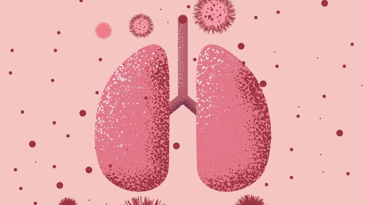 Soğuk Algınlığından Bir Süre Sonra Tüm Şikâyetler Geçmesine Rağmen Öksürük Neden Geçmek Bilmez?