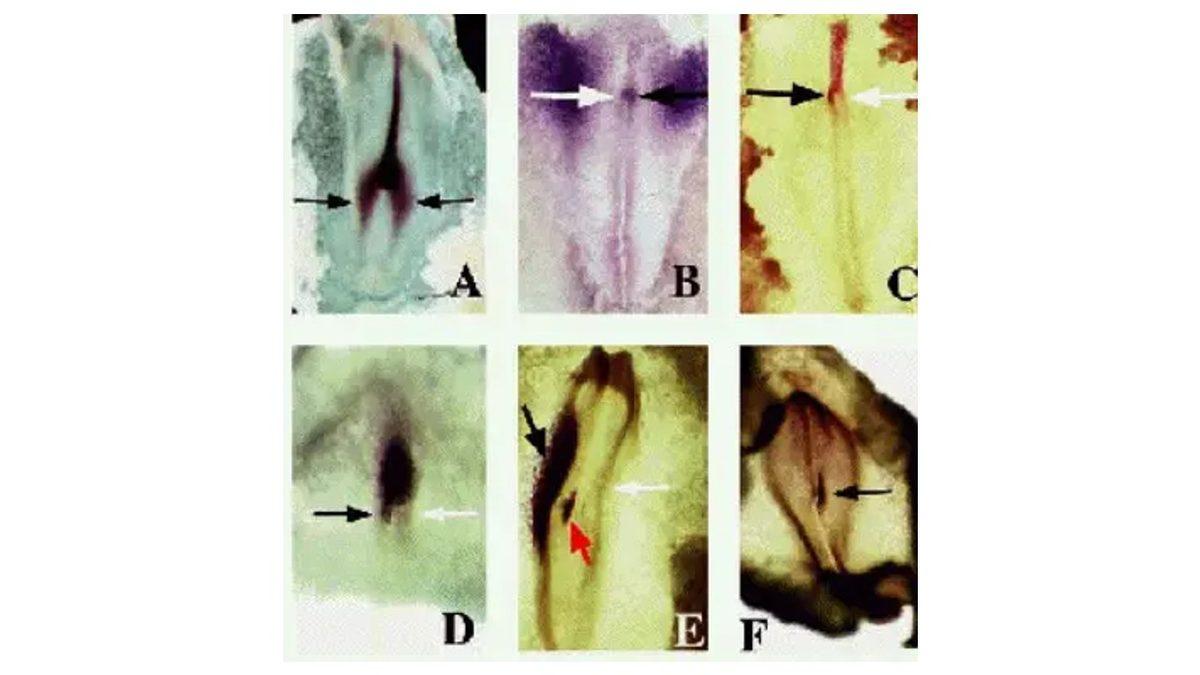 Vücudumuz Dıştan Simetrikken İç Organlarımız Neden Asimetrik? Sonradan Oluyormuş!
