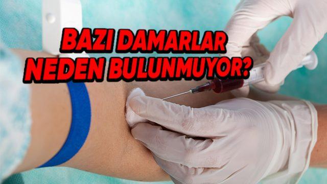 Bazılarımızın Damarları, Kan Verme Sırasında Neden Bu Kadar Zor Bulunur?