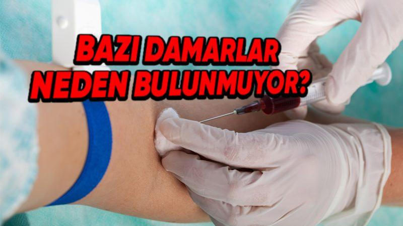 Bazılarımızın Damarları, Kan Verme Sırasında Neden Bu Kadar Zor Bulunur?
