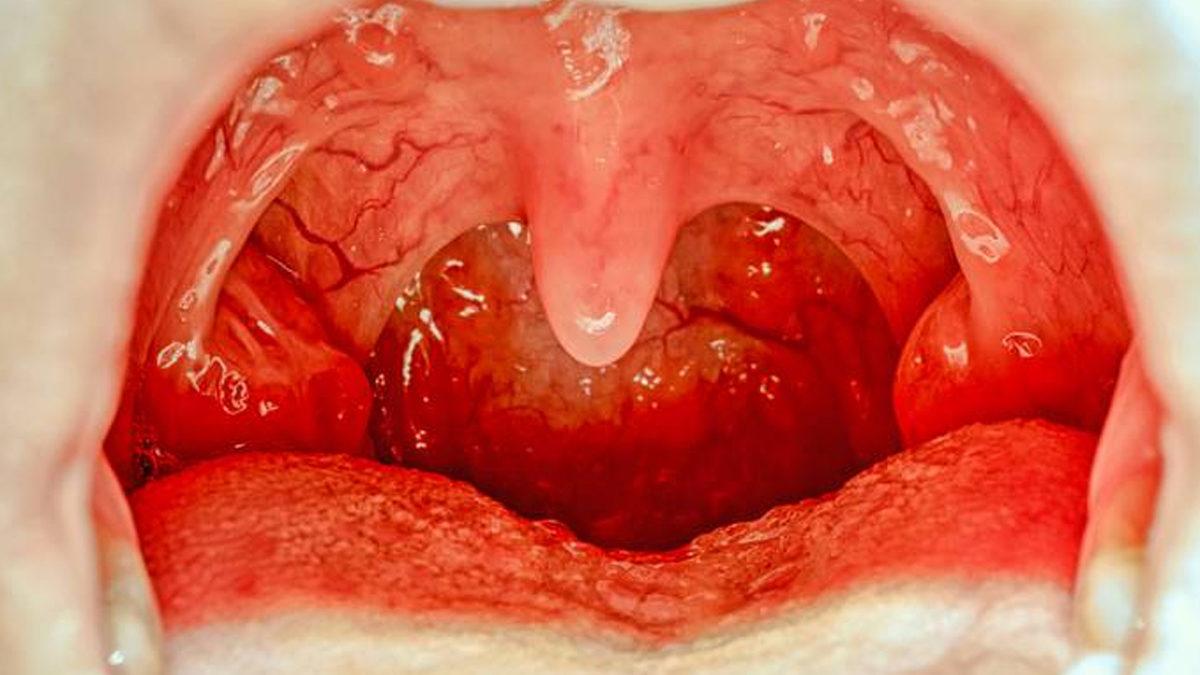 Ağız Boşluğumuzda Yer Alan ‘Küçük Dilimiz’ Tam Olarak Ne İşe Yarıyor, Olmasaydı Ne Olurdu?