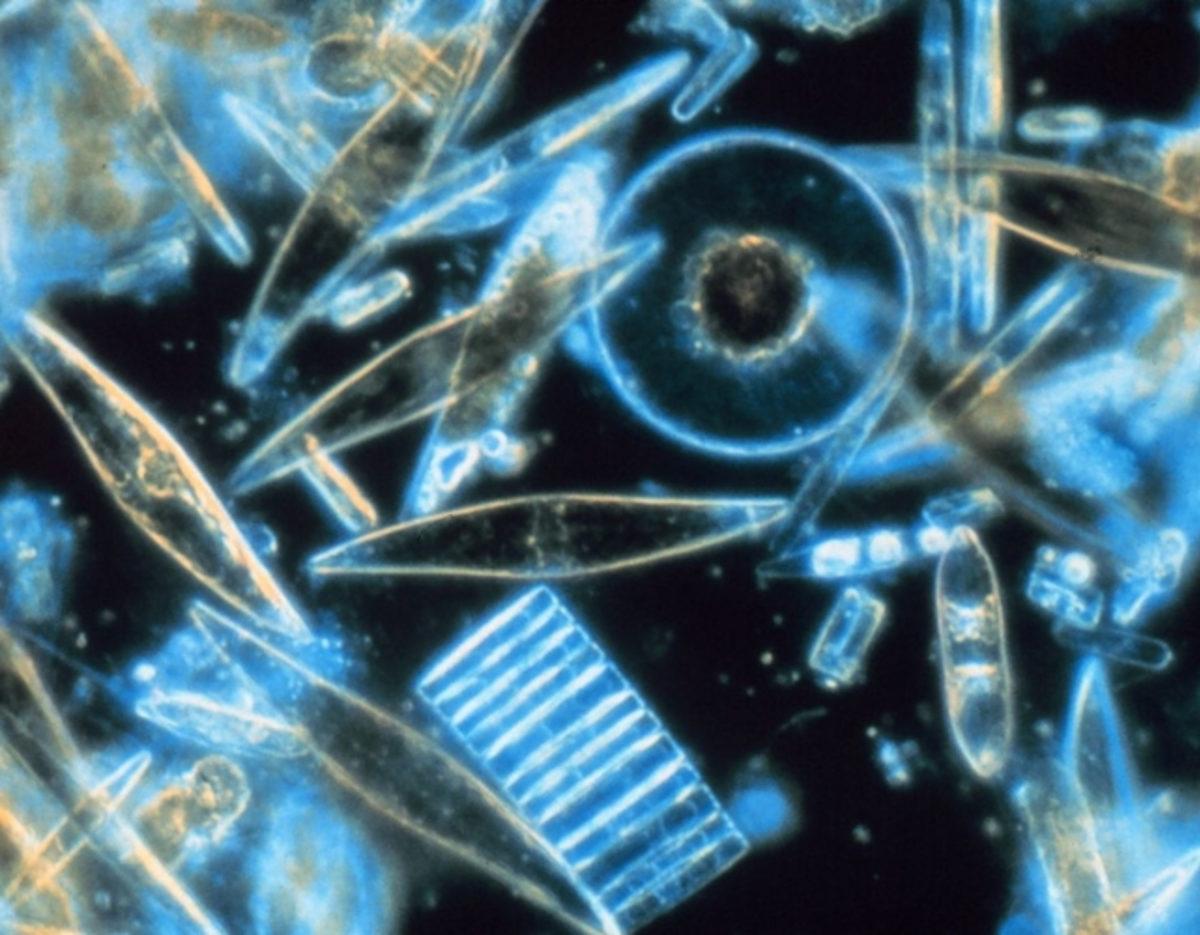 Yapay Tatlandırıcılar, Mikroorganizmaların Felaketi Olabilir (Bizim de)