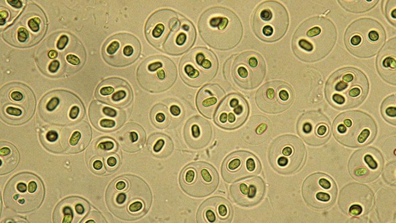 Yapay Tatlandırıcılar, Mikroorganizmaların Felaketi Olabilir (Bizim de)