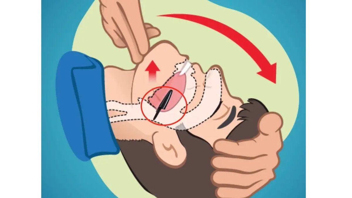 Tükenmez Kalemlerin Kapağındaki Deliğin Hayat Kurtarıcı Sebebi