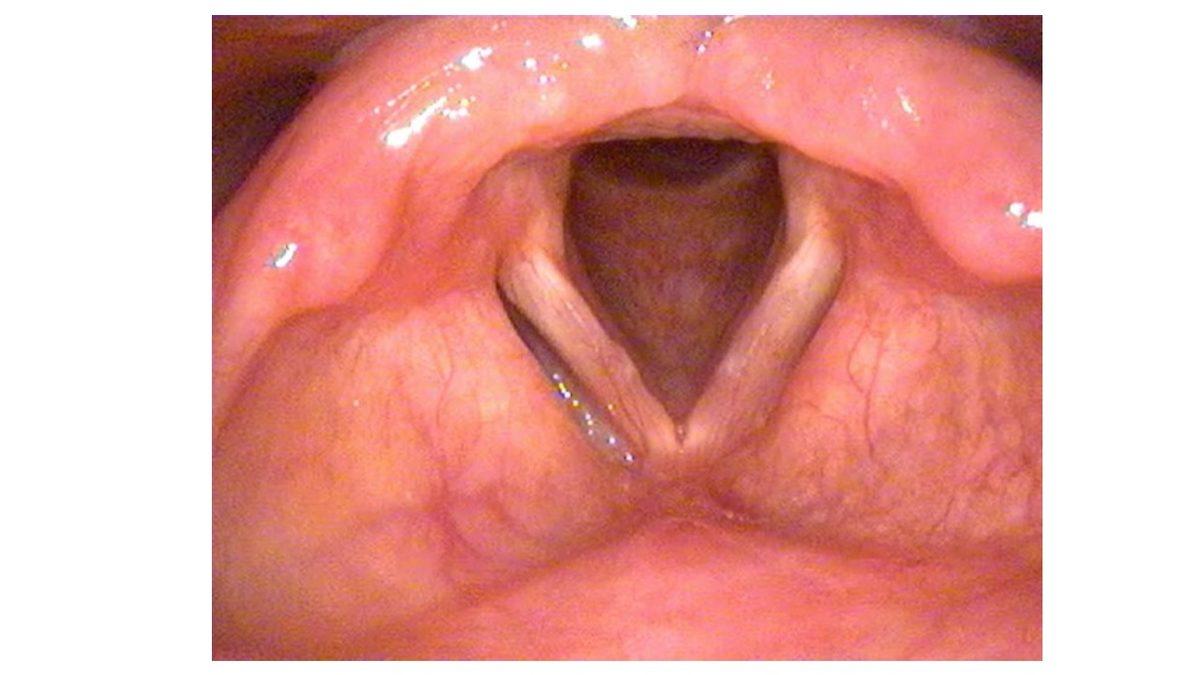 Bağırdığımızda Neden Sesimiz Kumandayla ’Volume’ Düşürülmüş Gibi Kısılıyor?