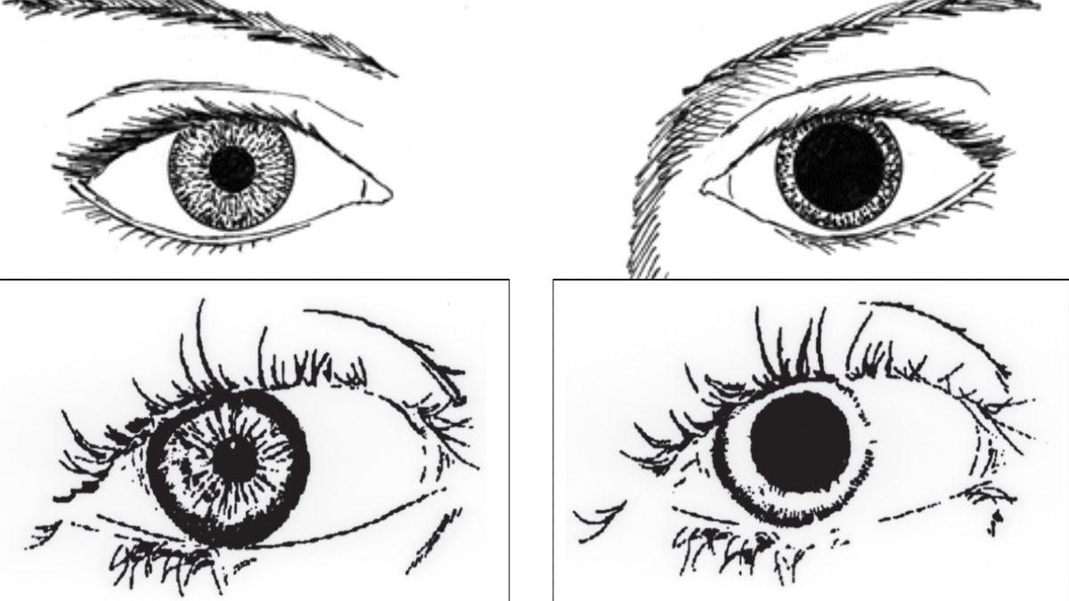 Kafadan Darbe Alınca Göze Işık Tutulmasının Hayati Öneme Sahip Nedeni