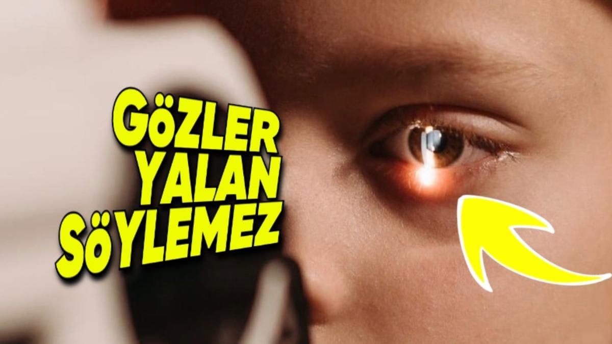 Kafadan Darbe Alınca Göze Işık Tutulmasının Hayati Öneme Sahip Nedeni