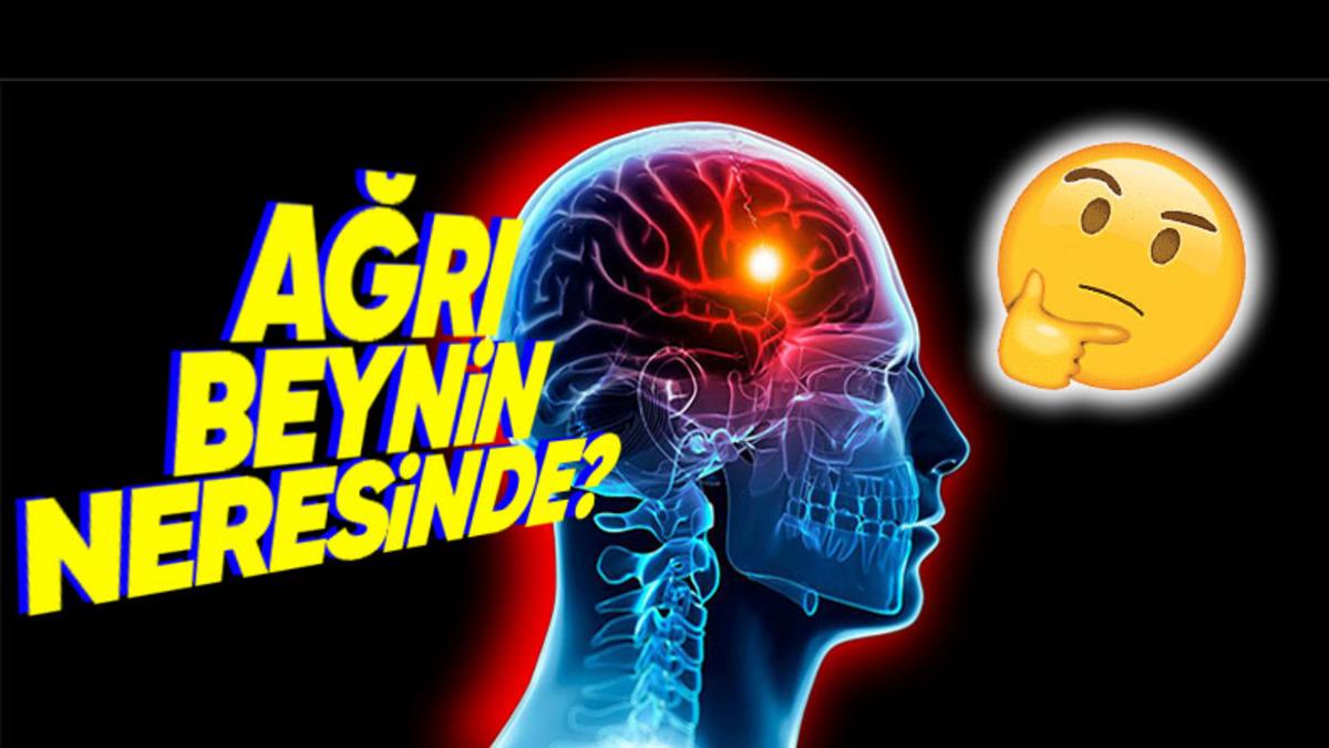 Beynimizin Hangi Kısmı Zarar Görüyor da Baş Ağrısı Yaşıyoruz? Cevap Sizi Şaşırtabilir!