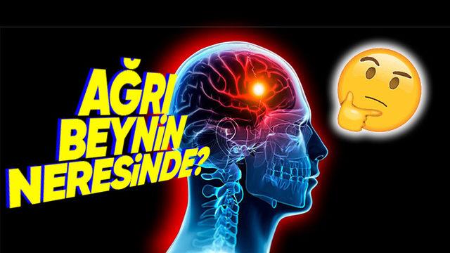 Beynimizin Hangi Kısmı Zarar Görüyor da Baş Ağrısı Yaşıyoruz? Cevap Sizi Şaşırtabilir!
