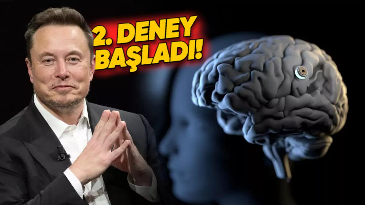 Elon Musk, Neuralink’in İkinci Kez Bir İnsanın Beynine Çip Yerleştirdiğini Açıkladı!