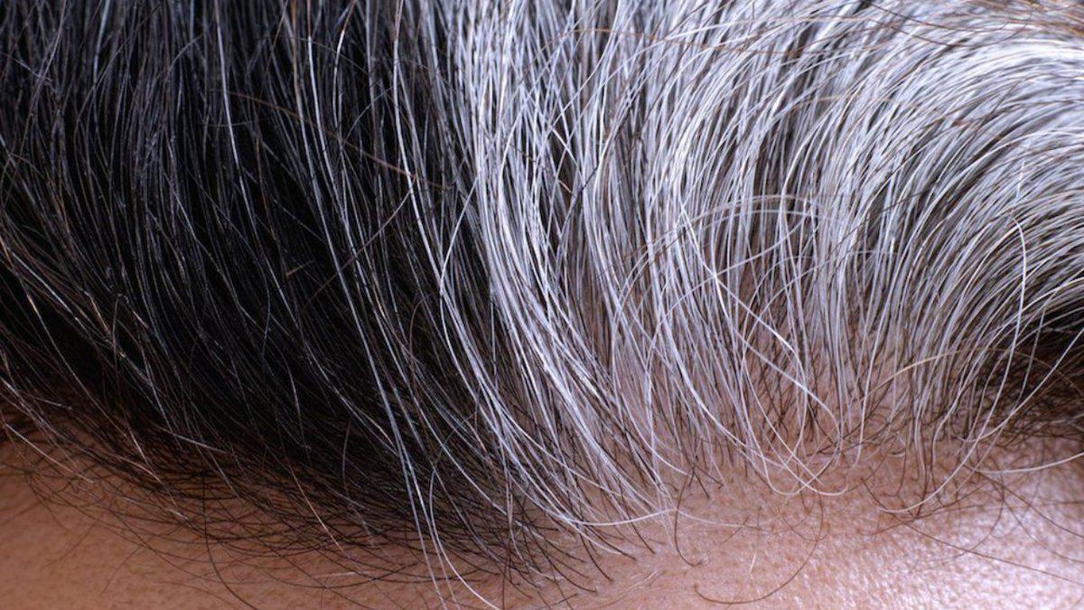 Stres Gerçekten Saç Beyazlatır mı, Yoksa Bu Bir Şehir Efsanesi mi?