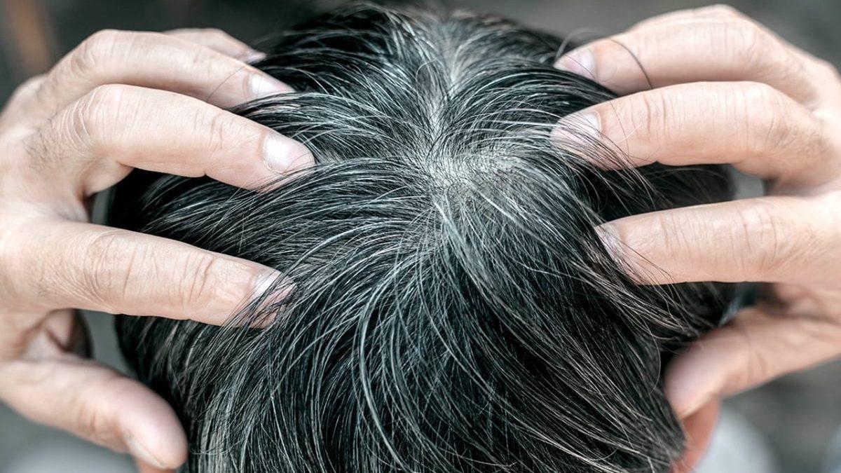 Stres Gerçekten Saç Beyazlatır mı, Yoksa Bu Bir Şehir Efsanesi mi?