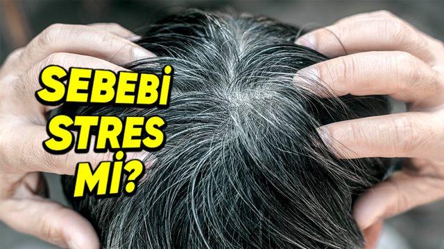 Stres Gerçekten Saç Beyazlatır mı, Yoksa Bu Bir Şehir Efsanesi mi?