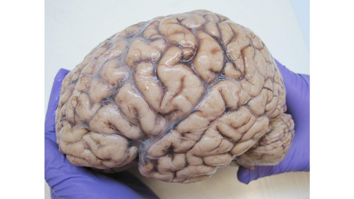 Her Yeni Yaş Aldığımızda Bizimle Yaşlanan Beynimize Zaman İçinde Neler Oluyor?