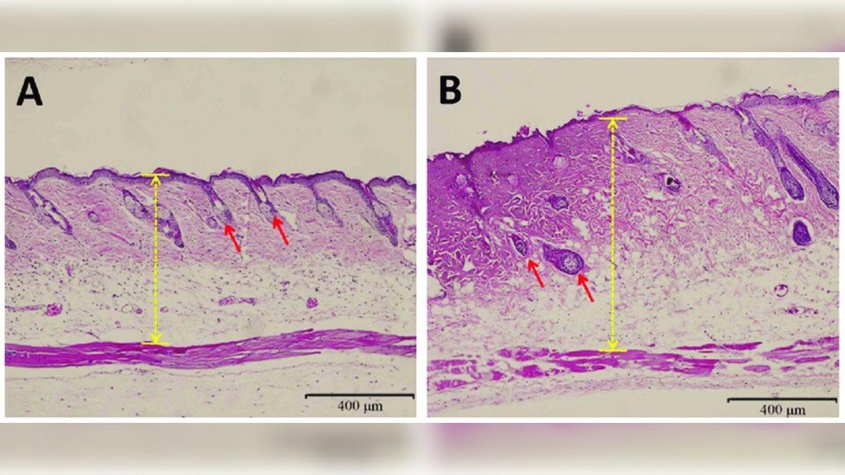 Tüm Memelilerde Olup İnsanlarda Olmayan Şeyin Ne Olduğunu Öğrenince ’Keşke Bizde de Olsaymış!’ Diyebilirsiniz