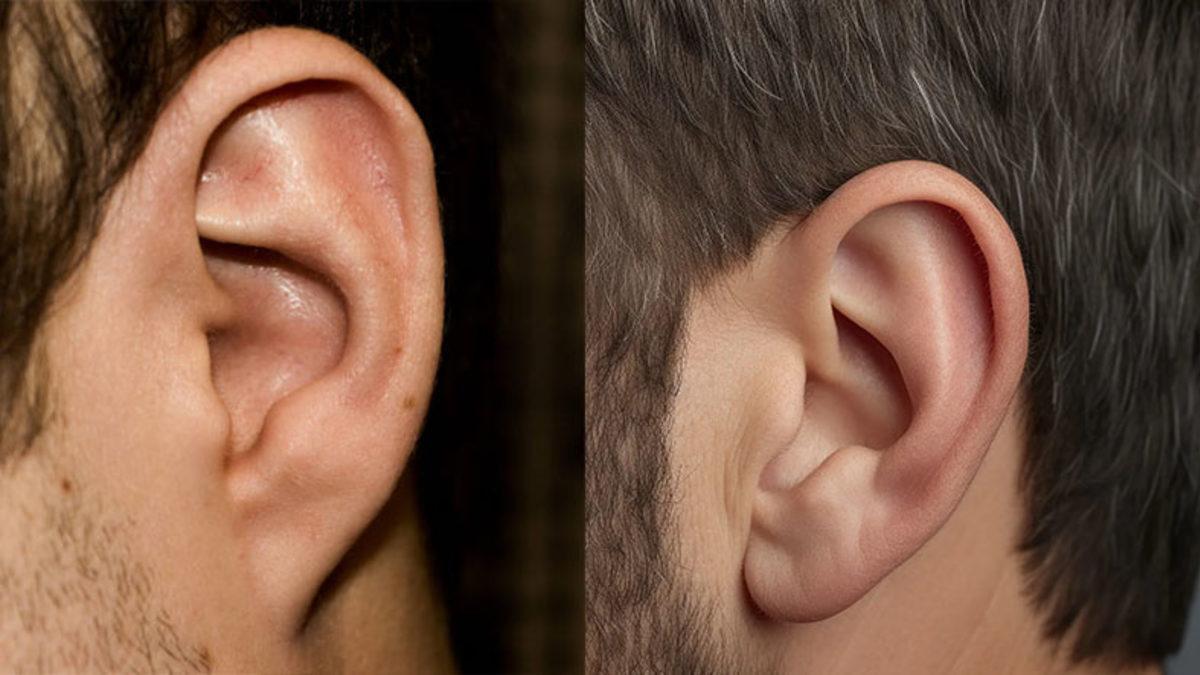 Bazı İnsanların Kulak Memesi Yapışıkken Bazılarının Neden Ayrık Olur?