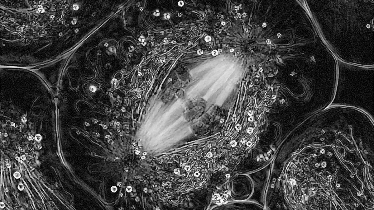 Bilim Bu Kadar İlerlemişken Yaşlanmayı Tersine Döndürmek Yakın Gelecekte Mümkün Olabilir mi?