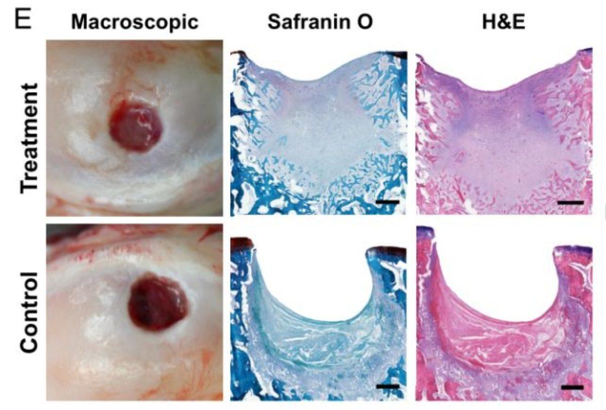 Yeni Bir Biyomateryal, Eklemlerdeki Hasar Görmüş Kıkırdakları Tedavi Edebilir