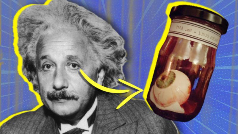 Einstein’ın Gözleri Neden Bedeninden Başka Bir Yerde? Para Kasasında Saklanıyormuş!