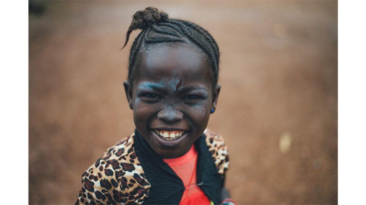 Neden Her İnsanın Birbirinden Farklı Burun Delikleri Oluyor? Üstelik Genetik Tek Sebep Değil!