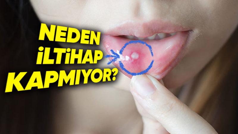 Vücudumuzun Herhangi Bir Yerindeki Yaralar Hemen İltihaplanırken Ağızda Oluşan Yaralar Neden İltihaplanmıyor?