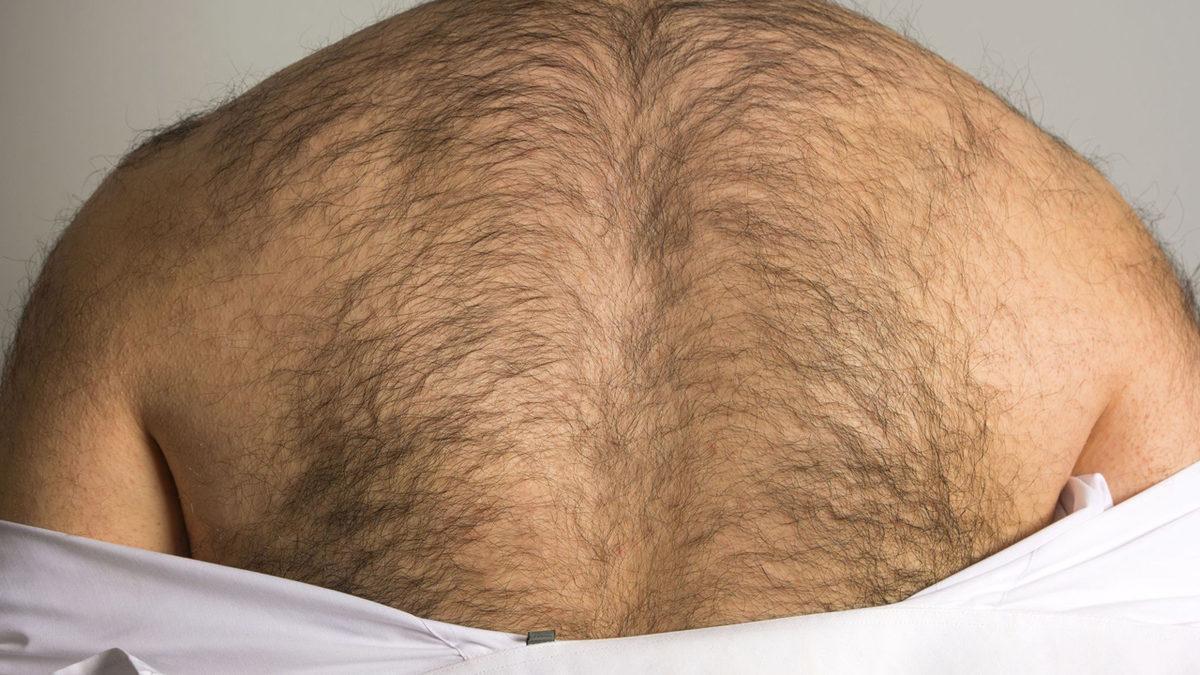 Vücudumuzun Bazı Bölgelerinde Neden Daha Yoğun Kıl Varken Bazı Yerlerinde Neredeyse Gözükmeyecek Kadar Az?