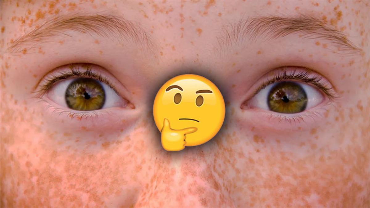 Çiller Nasıl Oluşuyor, Niye Her İnsanda Olmuyor?