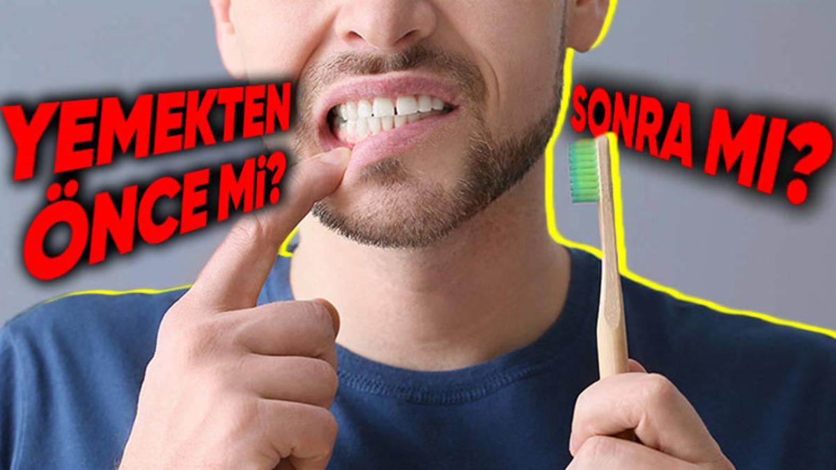 Yemekten Sonra Hemen Dişinizi Fırçalıyorsanız Bu Yazıyı Okuduktan Sonra Artık Biraz Beklemek İsteyebilirsiniz