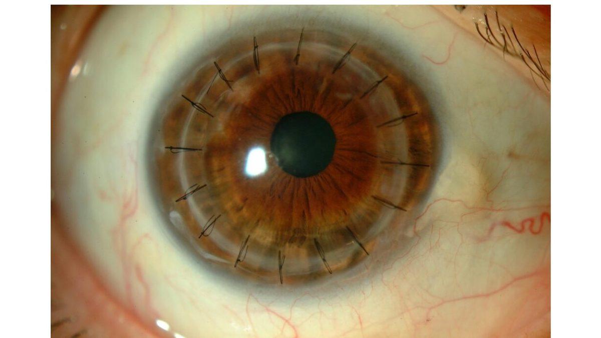 Vücudumuzda Kan Damarı Olmayan Tek Yer Neresi? Eğer Orada da Olsaydı Hayatımız Çok Farklı Olabilirdi!