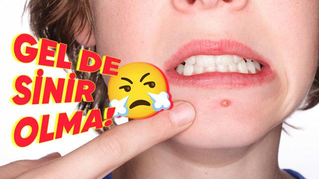 Ergenlerin Canını Sıkan Sivilceler Neden Gençliğin En Güzel Dönemlerinde Baş Belası Hâline Geliyor?