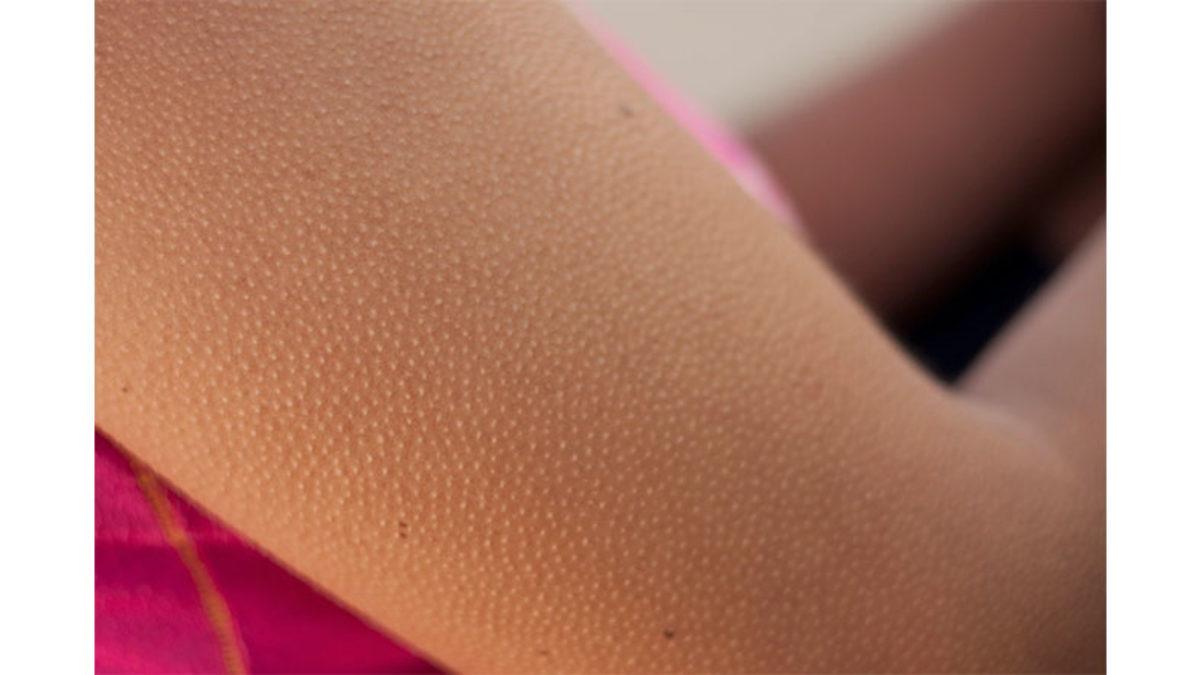 Bazı Müzikleri Dinlerken Neden Tüylerimiz Diken Diken Olur? Aslında Bu Bir Çeşit ’Orgazm’