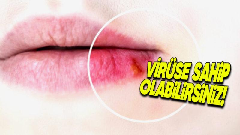 Stresliyken Niye Uçuk Çıkartıyoruz? Vücudunuzda Haberiniz Olmayan Bir Şey Sinsice Aktive Oluyor!