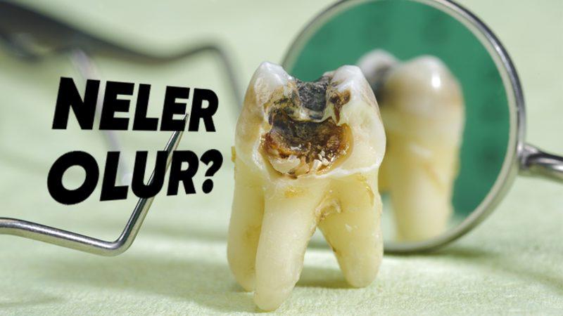 Dişlerinizi Fırçalamayı Aniden Bırakırsanız Neler Olur? Çürümekten Daha Fazlası Var...