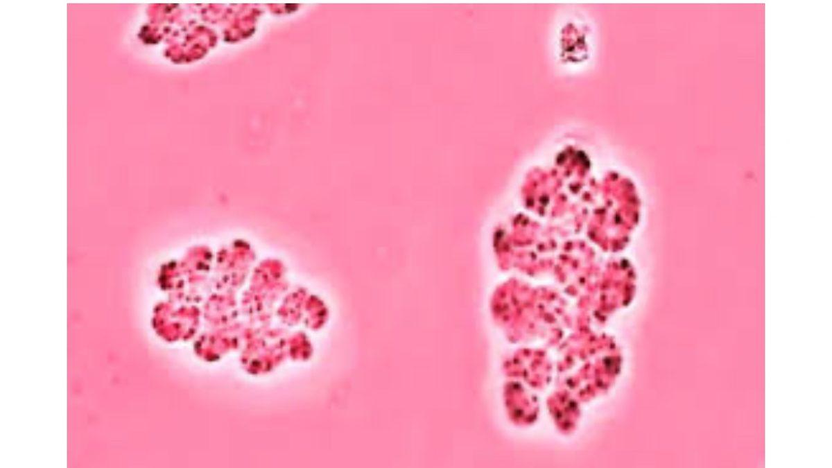 Senegal’deki Bu Göl Neden Böyle Pespembe? (Bir Canlı Sayesindeymiş!)