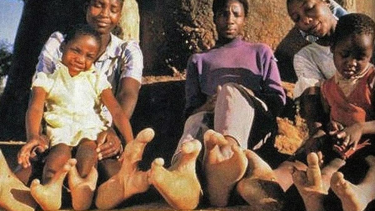 Afrika Kabilesindeki Bu İnsanların Neden Devekuşu Gibi 2 Parmaklı Ayakları Var?