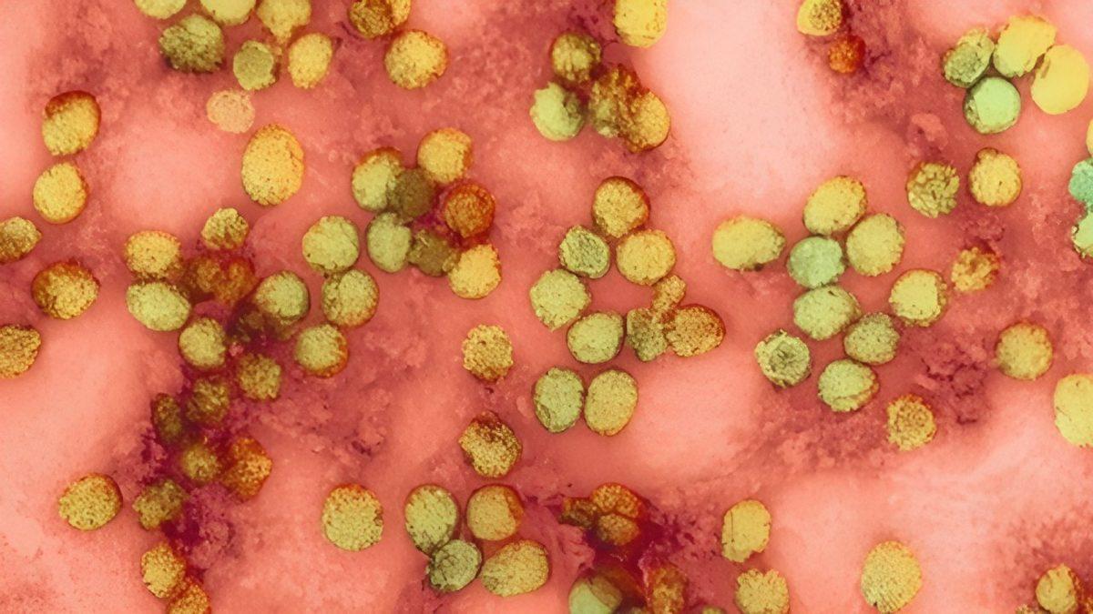 Sarıhummanın Bulaşıcı Olmadığını İspatlamak İçin Kusmuk İçen Doktor Stubbins Ffirth’in Ağızları Açık Bırakacak Hikâyesi