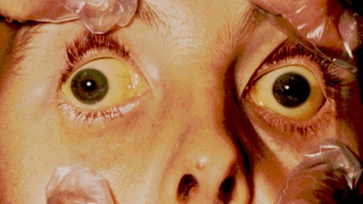 Sarıhummanın Bulaşıcı Olmadığını İspatlamak İçin Kusmuk İçen Doktor Stubbins Ffirth’in Ağızları Açık Bırakacak Hikâyesi