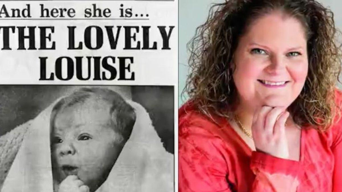 Dünyanın İlk Tüp Bebeği Louise Brown’ın Mucizevi Doğum Hikâyesi