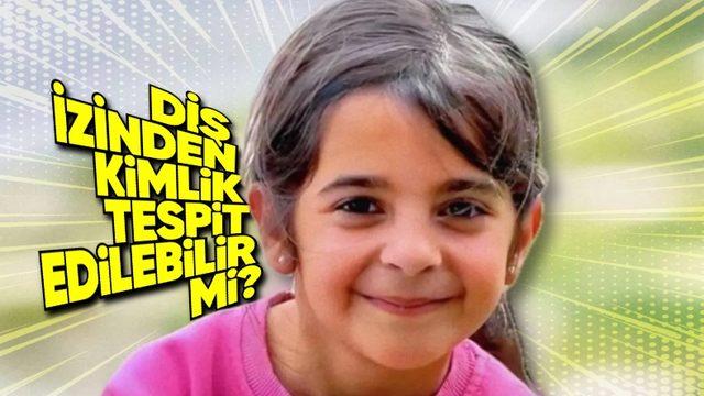Kayıp Narin Olayı Diş İzinden Çözülür mü, Tıpkı Parmak İzinde Olduğu Gibi Diş İzimizden de Kimlik Tespit Edilir mi? İşte Bilimin Cevabı