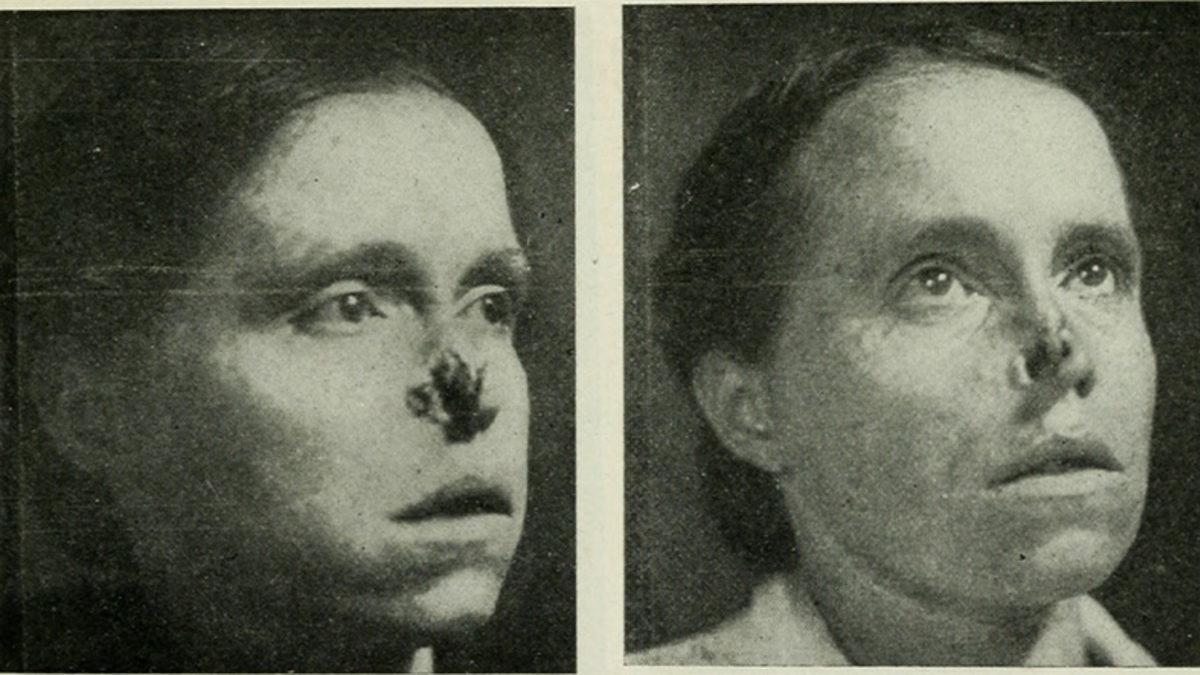 Kendi Hayatlarını Kaybettiler Ama Binlercesini Kurtardılar: Radyum Kızlarının Her Satırını Tüyleriniz Diken Diken Okuyacağınız Kahramanlık Hikâyesi